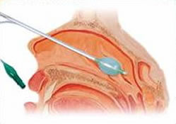 B1_ab598.jpg