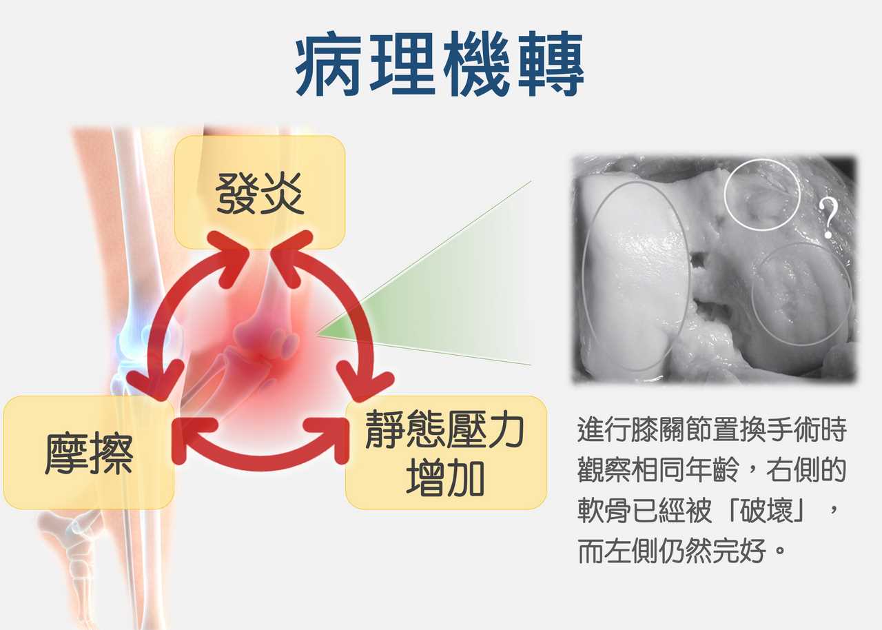 微創人工膝關節手術