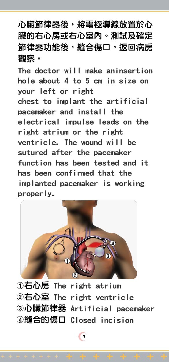 Pacemaker care 02 page 0007 7bae5