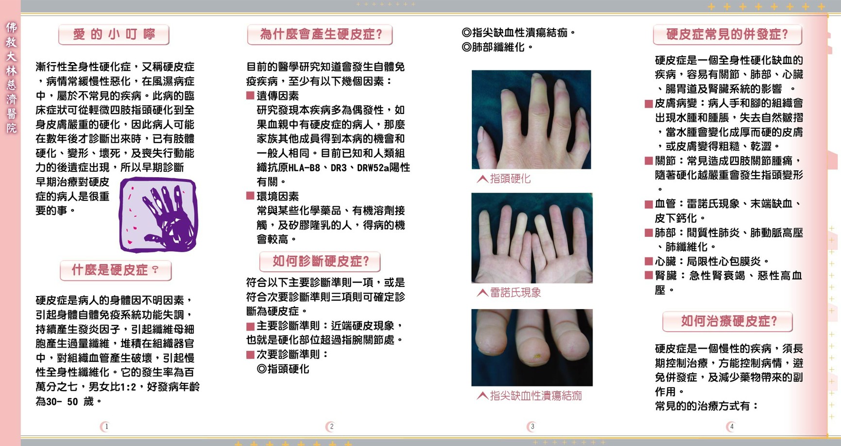 systemic sclerosis 2